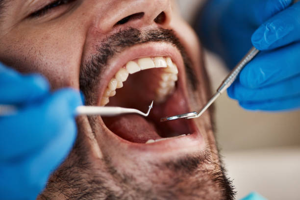 Best Emergency Dental Care for Broken or Chipped Teeth in Durant, IA