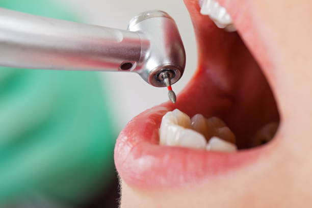 Best Pediatric Emergency Dentist in Durant, IA